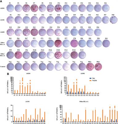 Screening and Identification of HBV Epitopes Restricted by Multiple Prevalent HLA-A Allotypes